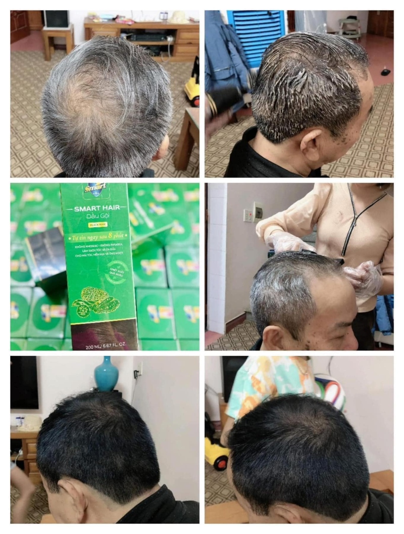 dầu gội phủ bạc smart hair