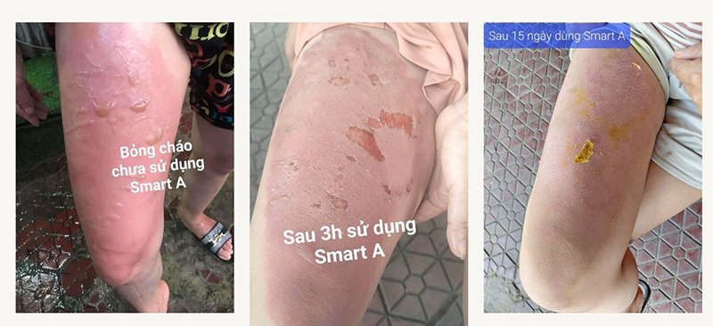 mước muối điện phân smart a