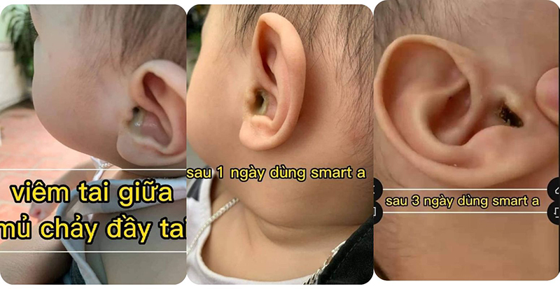 smart a nước muối điện phân