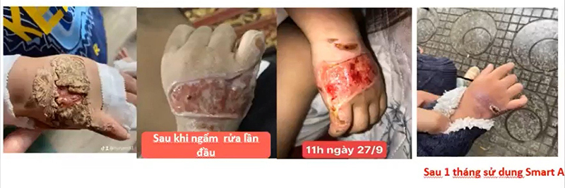 smart a nước muối điện hóa